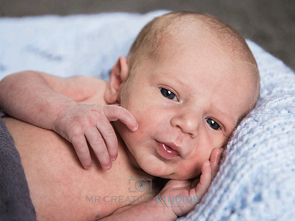 Before Gentle Skin Retouching